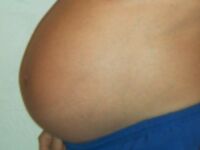 belly: