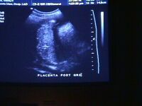 placenta: 